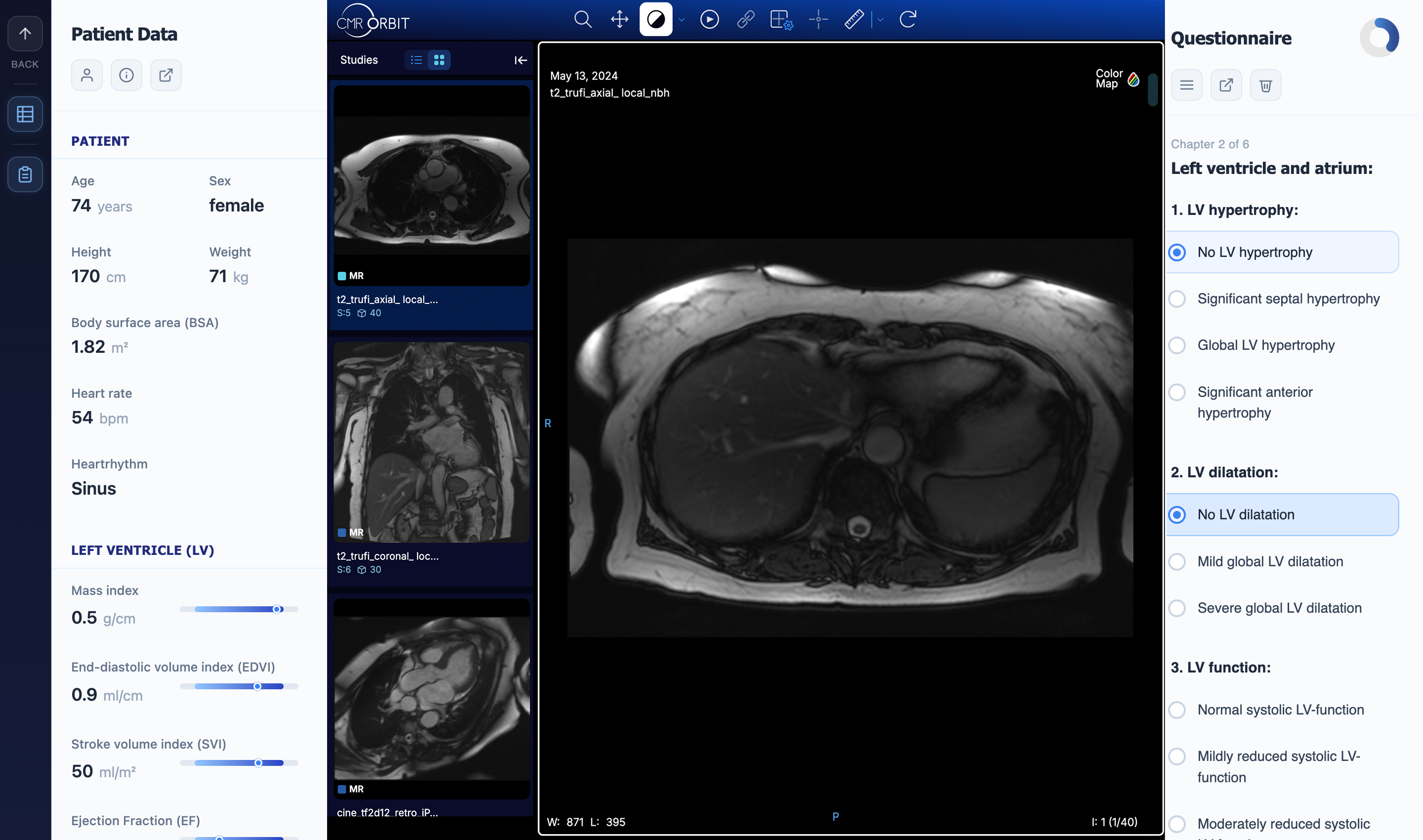 CMR Orbit — Interactive quiz and diagnosis module